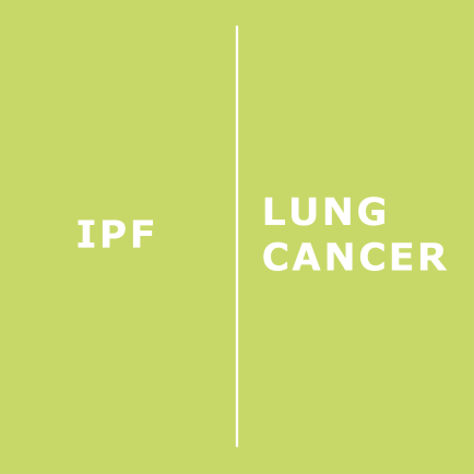 news-ipf-lung-cancer-surgery.png